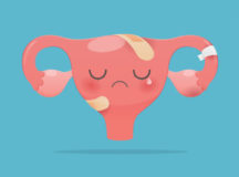 Cartoon with uterus health concept on green background, Sick uterus