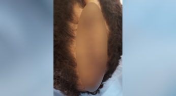 Suspeito corta couro cabeludo de filho ao alegar que seria corte “homossexual”