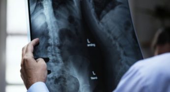 Deficiência de fosfato e problemas ósseos
