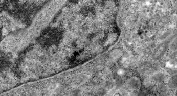 Covid-19: o que se sabe até agora da variante Ômicron